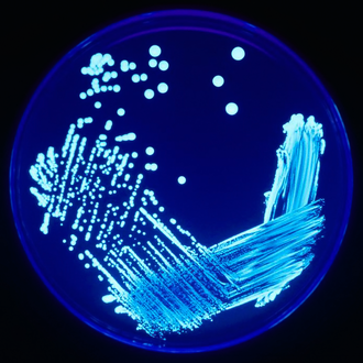 Legionella e trattamento al punto d’uso